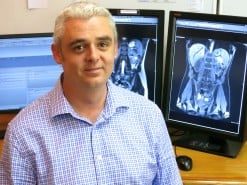 Dr Braham van der Merwe | SCP Radiologist | SCP Director