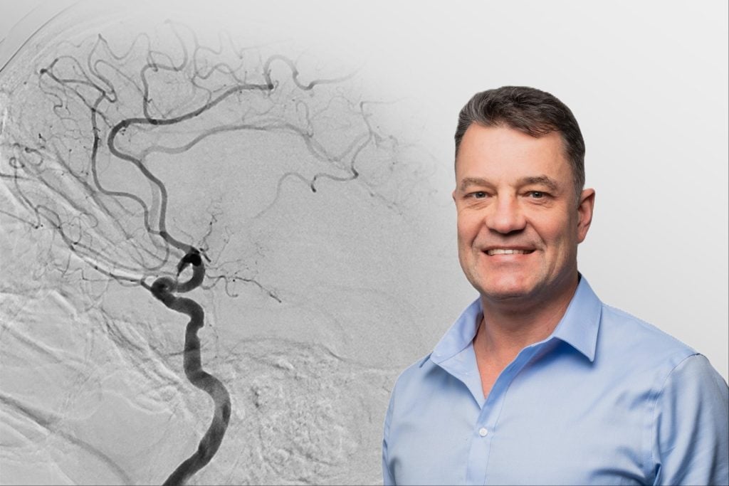 Dr Hofmeyr Viljoen, a Neuroradiologist from SCP Radiology, expert in diagnosing and treating stroke.
