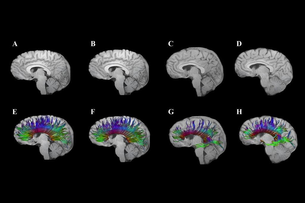 Head Injury Enhanced Image