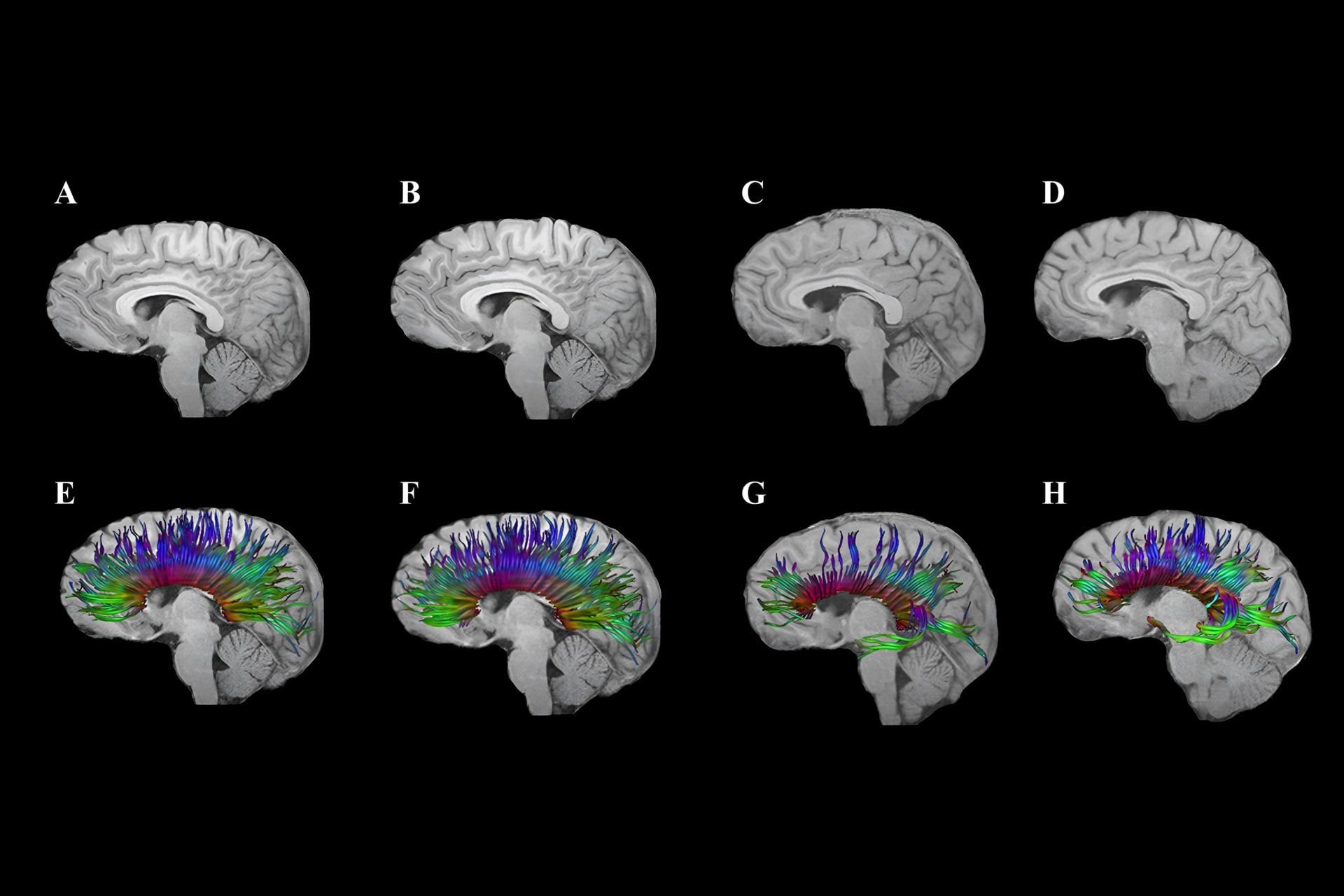 Blows to the brain: The hidden crisis in contact sport